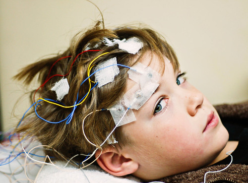 EEG Test Wrong Autism Community Forum