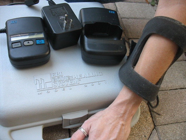 Bone Growth Stimulator Bone Growth Stimulator 400 EBI … Flickr