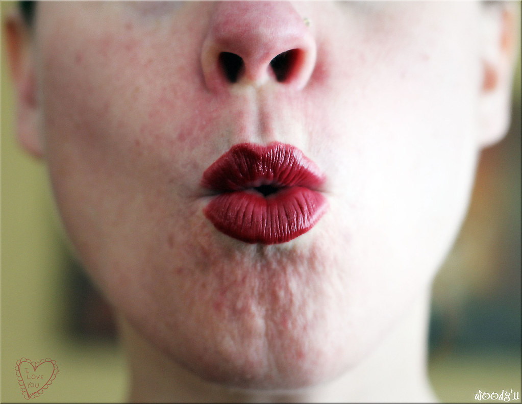 Type 1 and Type 2 Herpes Whats the Difference?