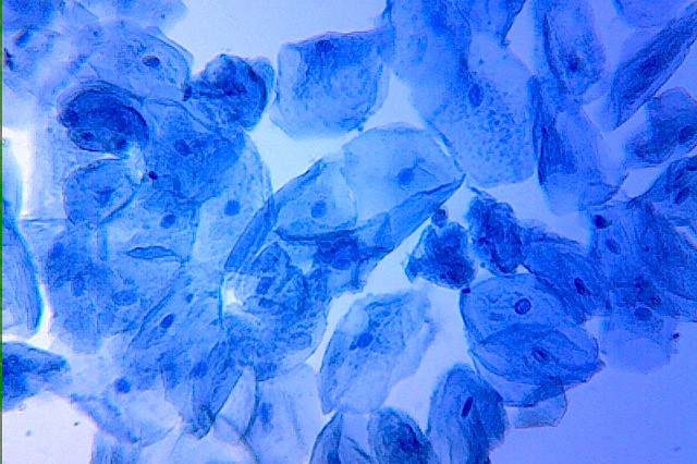 Human cheek cells Flickr Photo Sharing!