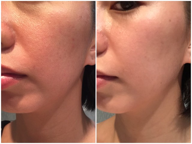 A Review of Snow Caps Glutathione Greta's Junkyard