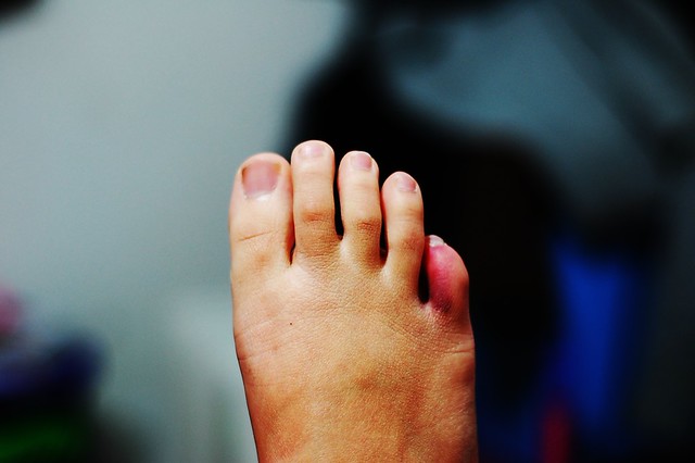 pinky toe Flickr Photo Sharing!