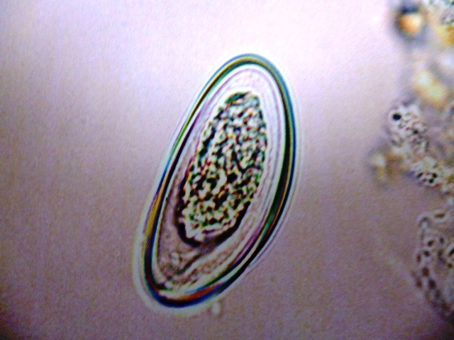 Pinworm eggs Flickr Photo Sharing!