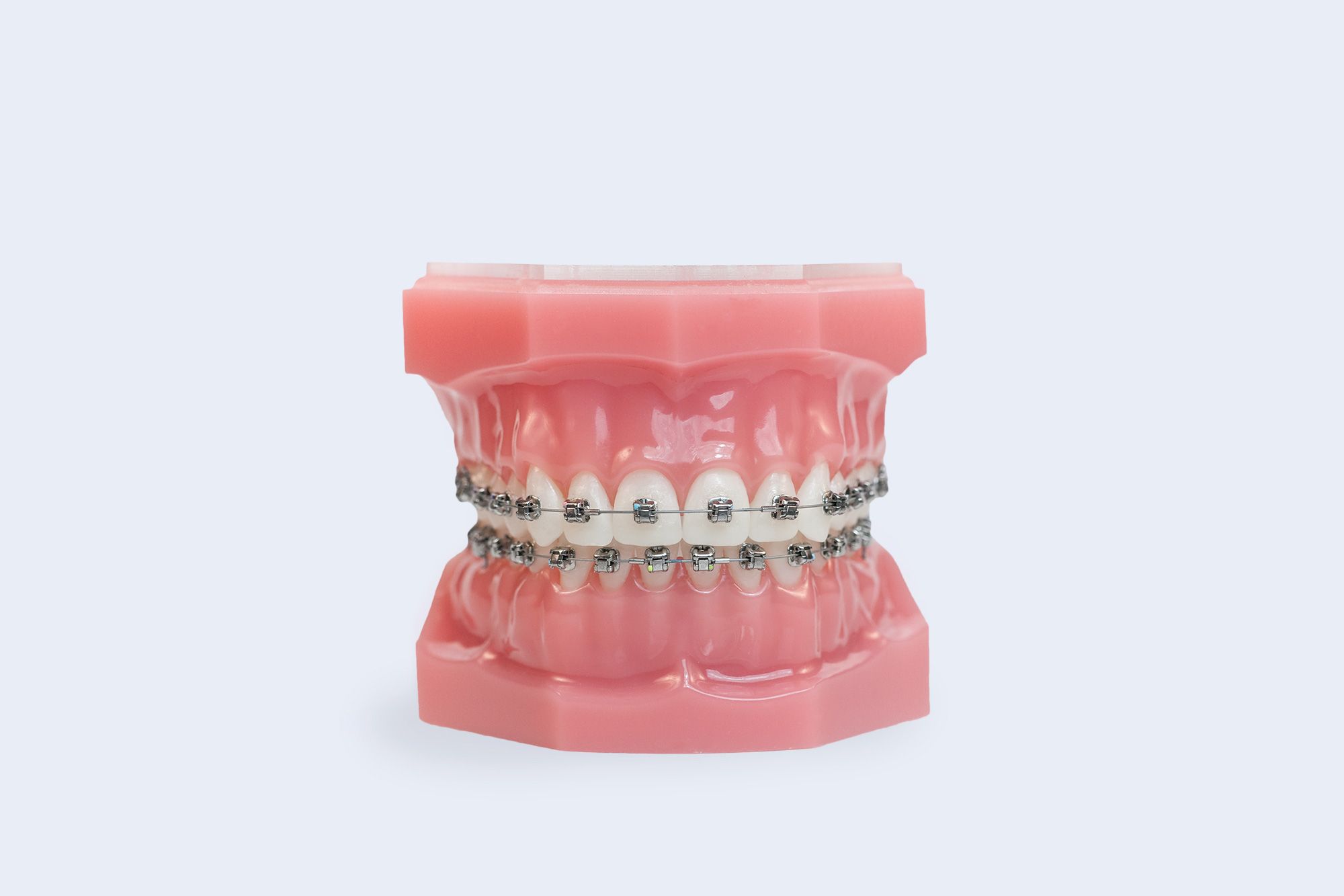 Metal Braces Braces Edmond Oklahoma City Braces