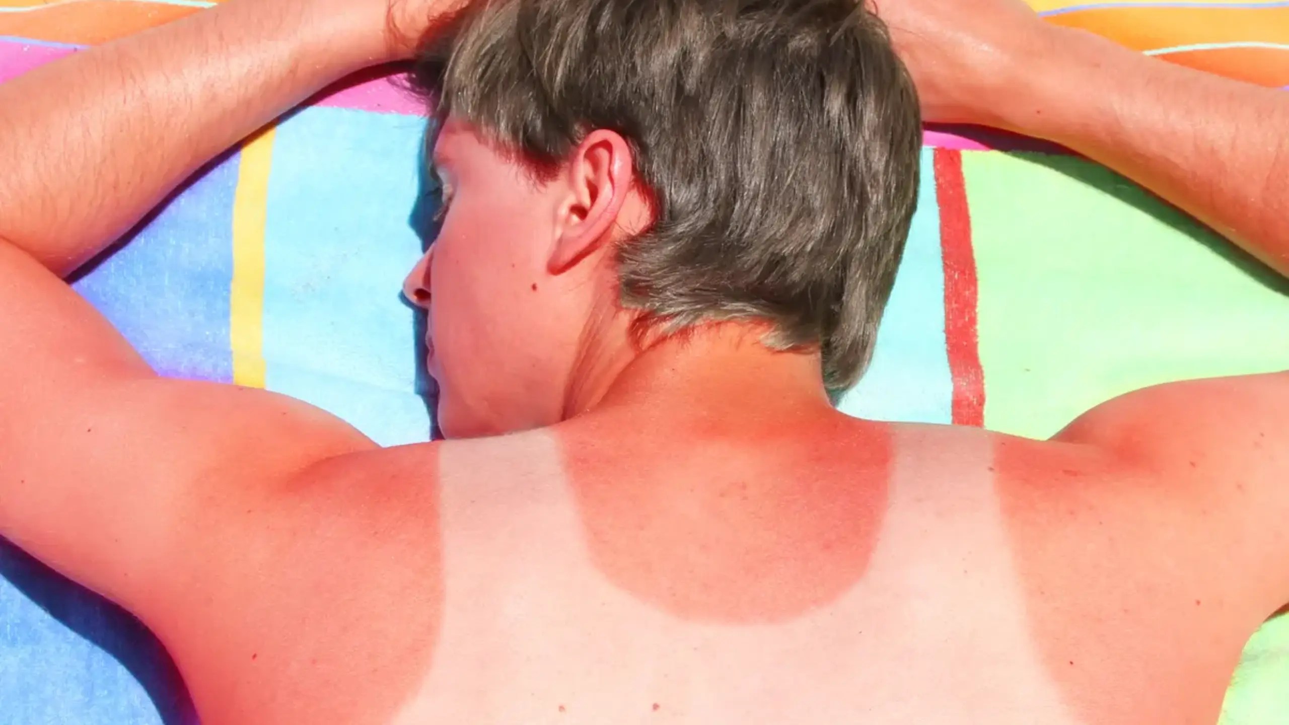 How to Get Rid of Hell's Itch