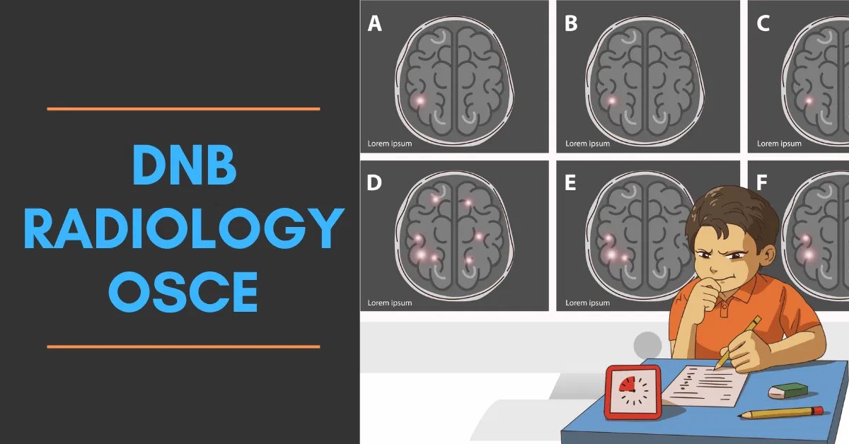 DNB Radiology OSCE Tips and Tricks RadioGyan