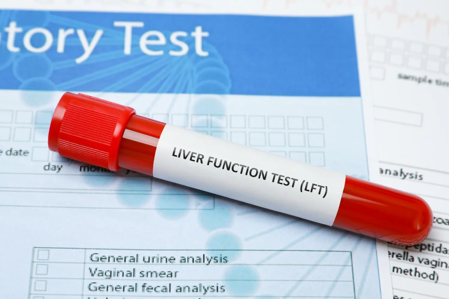 Liver Function Tests Decoding the Results fatty15