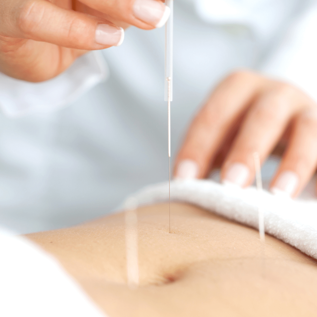 Endometriosis and Acupuncture Full Circle Health Network