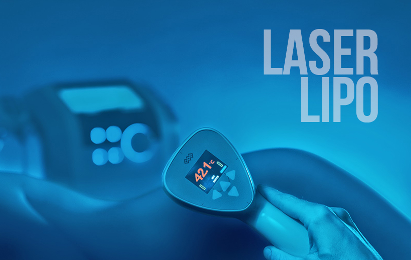 Laser Lipo Smart Lipo Vancouver False Creek Skin Solution Clinic