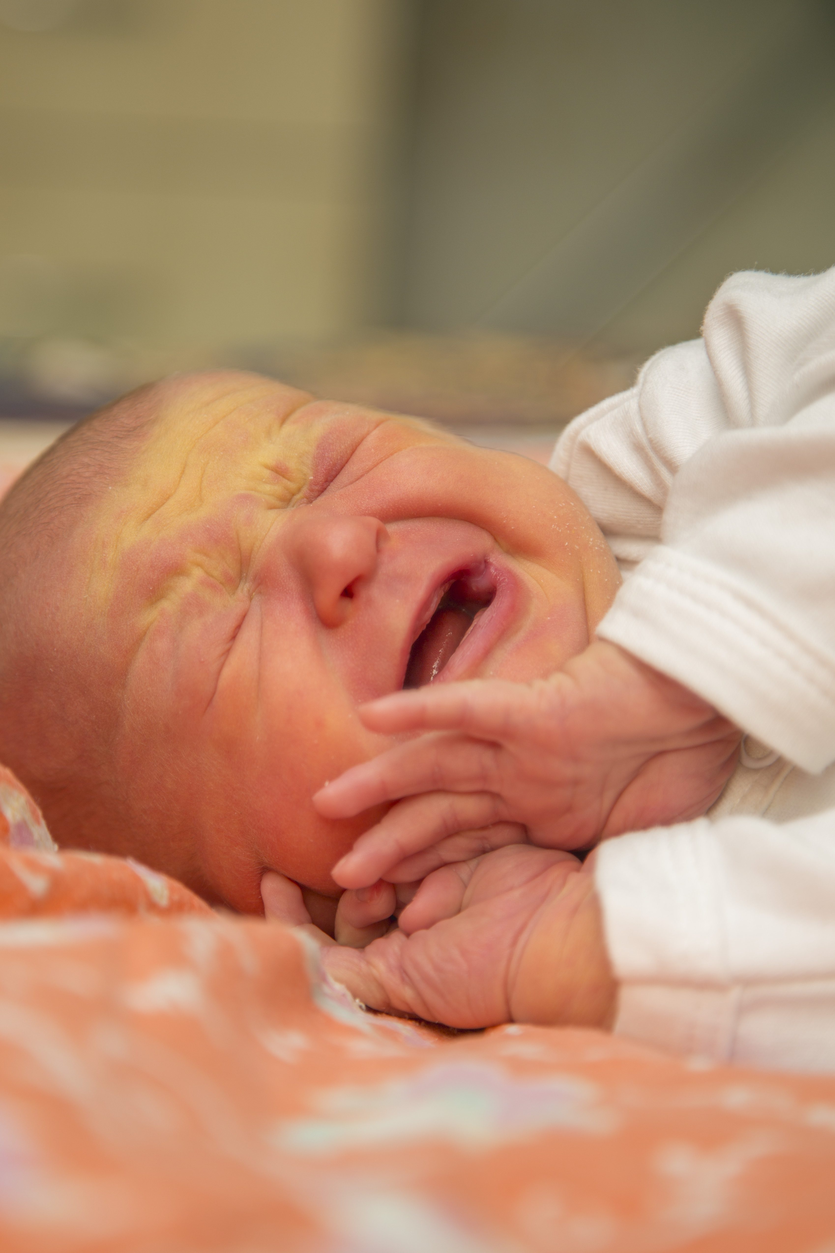 Why Fed is Best for Newborn Jaundice A Parent Guide Fed Is Best