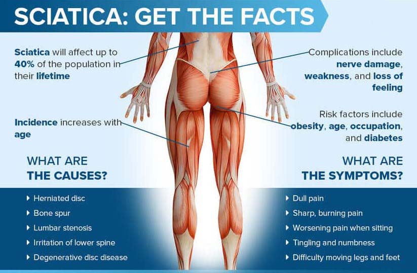 Can Flat Shoes Cause Sciatica? [Symptoms and Treatment]