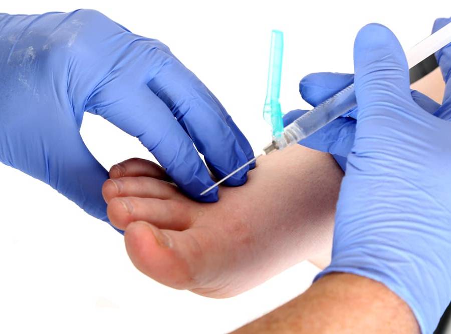 Foot Injection Therapy Feet In Motion