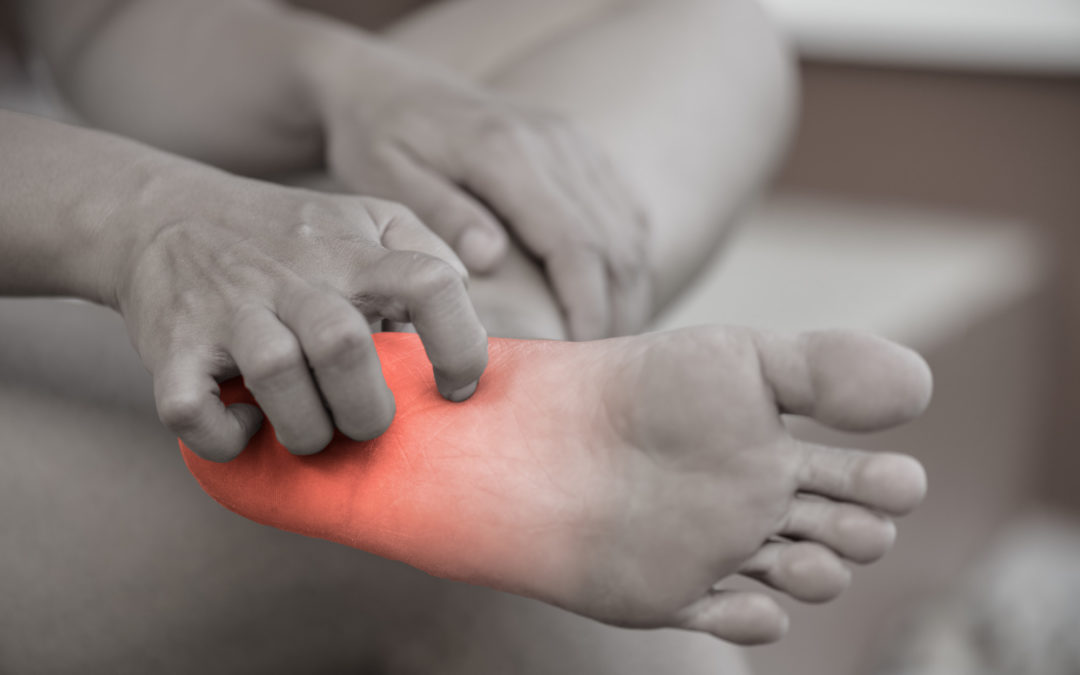 How To Stop Itchy Feet Right Away Feet In Motion Blog(01)