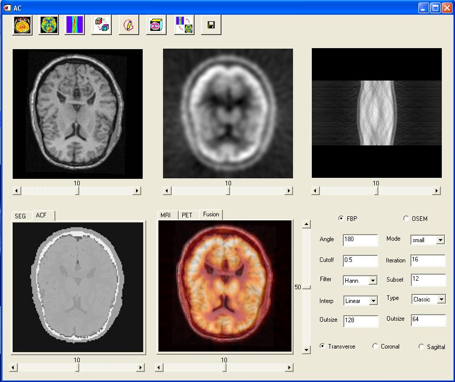 Attenuation Correction • Quantitative Bioimaging Laboratory