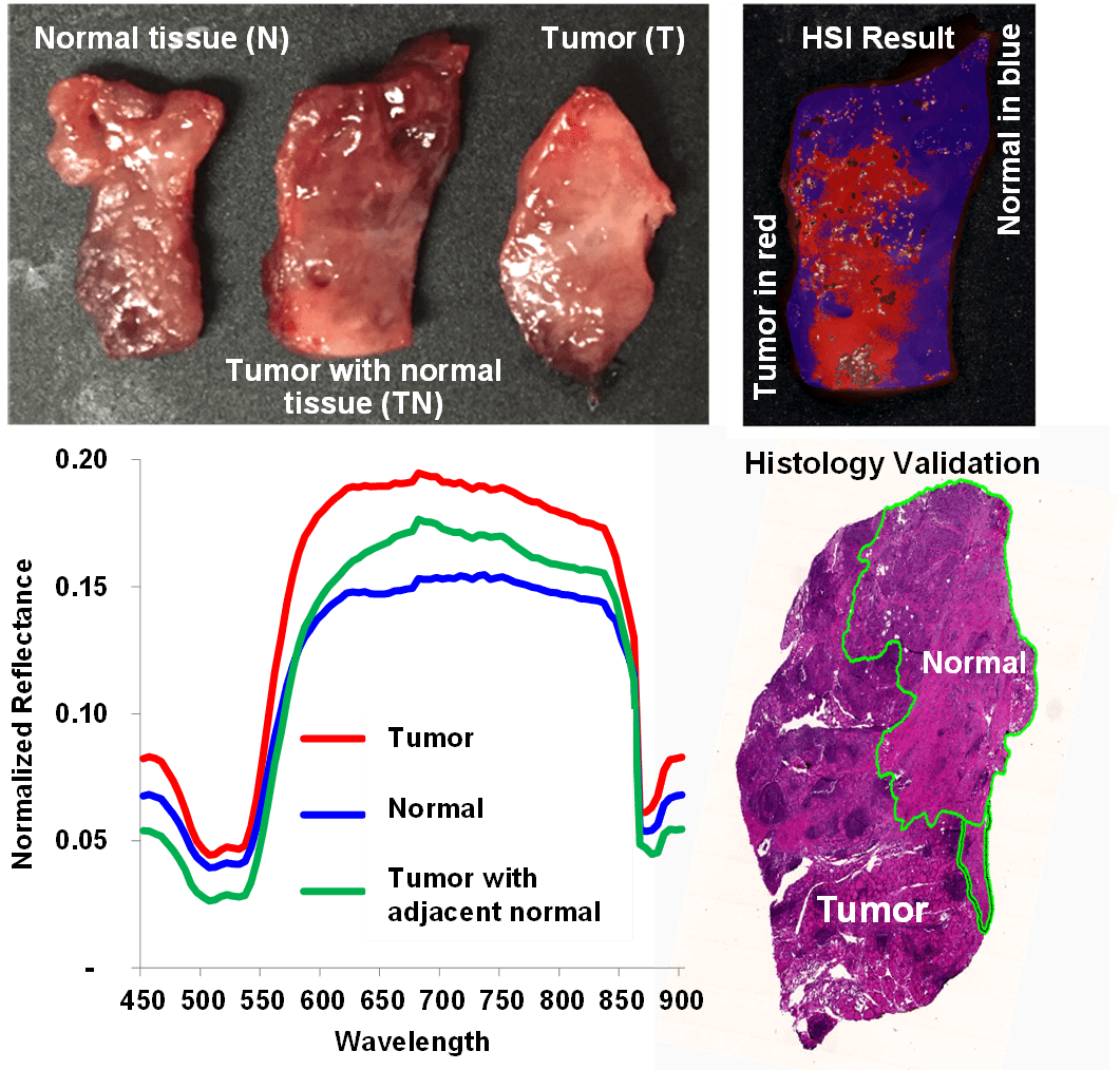 Labelfree HSI for Surgical Margin Assessment • Quantitative Bioimaging