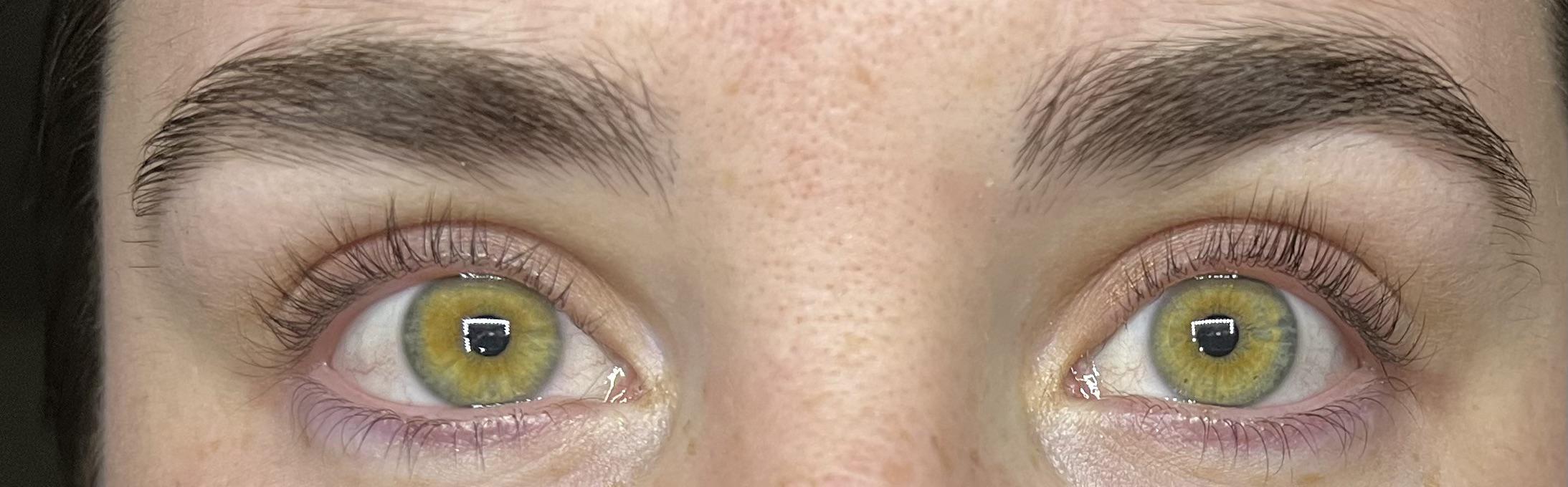 This Is What Happens If Someone Takes Cod Liver Oil Every Day Femanin