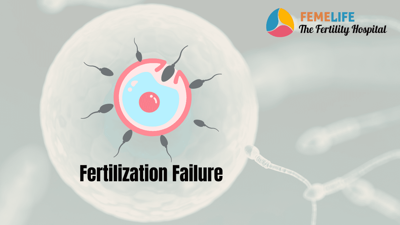 Fertilization Failure in IVF Treatment FEMELIFE
