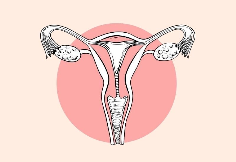 Ovarian Hyperstimulation Syndrome Symptoms And Causes
