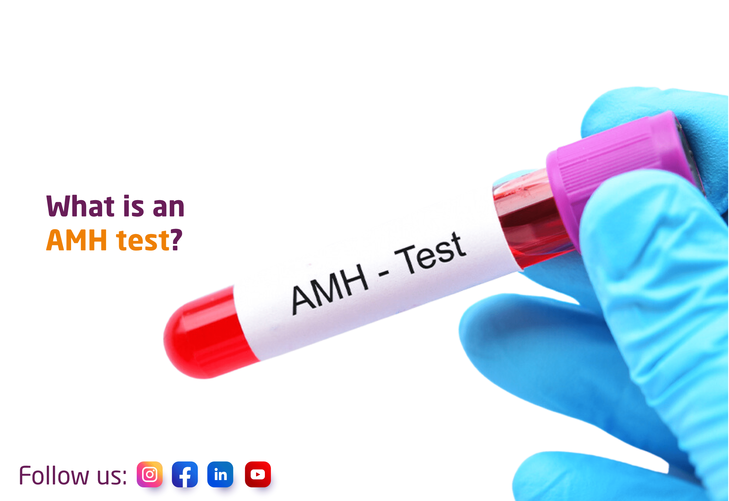 What is an AMH test?