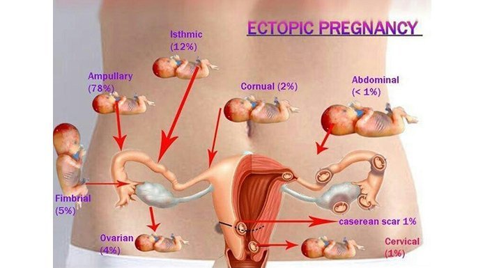 Smoking Affects The Fertility Of Men And Women Fertility Road Magazine