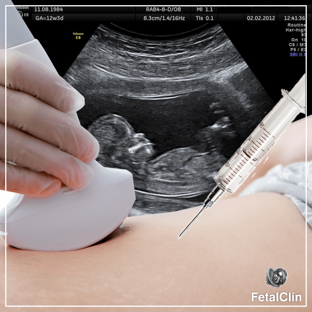 Exames FetalClin Medicina Fetal em União da Vitória