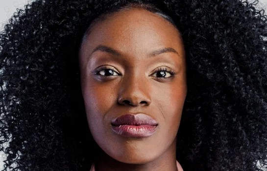 All Your Botox Questions, Answered RealSelf