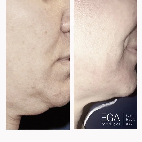 EGA Medical New York New York, New York Realself