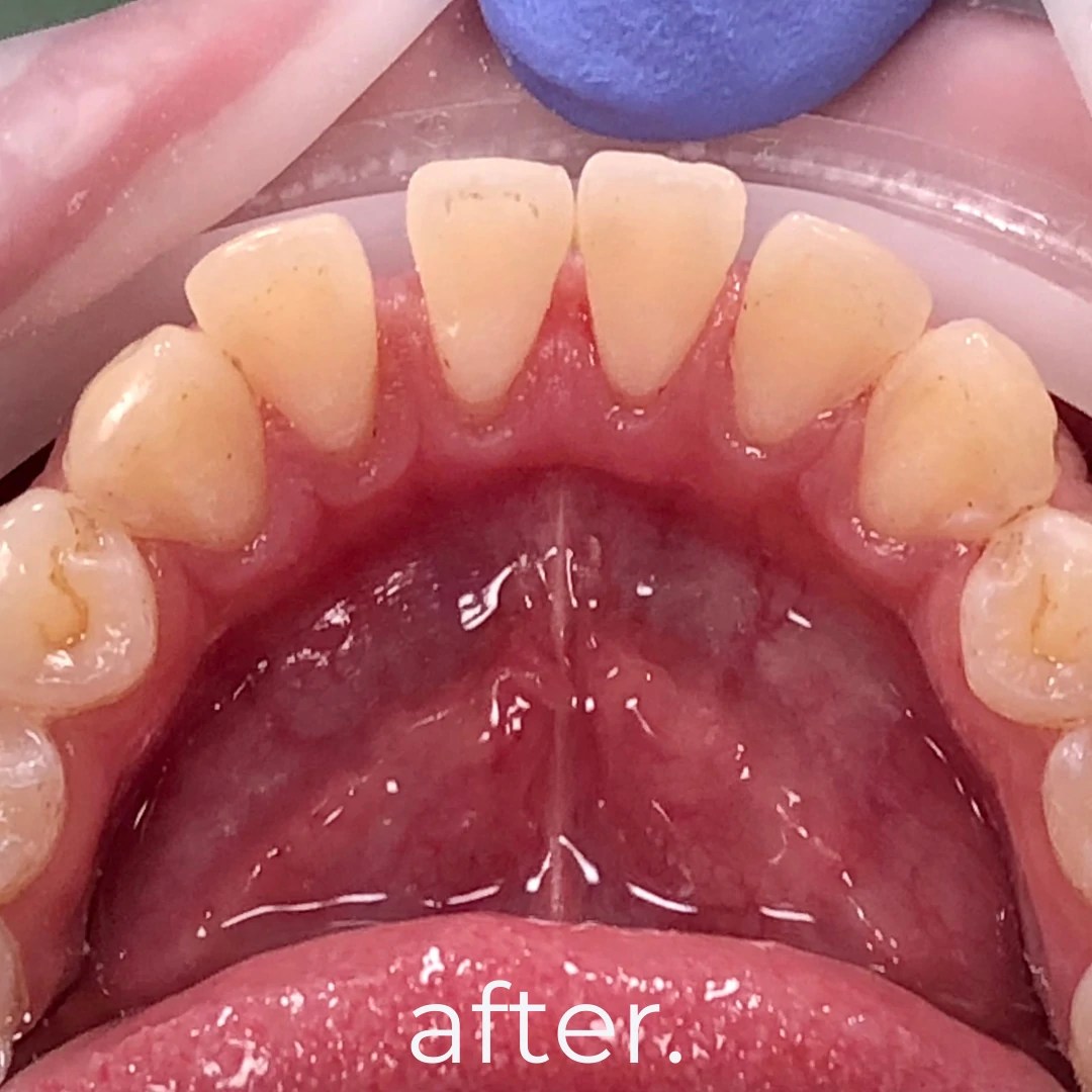 Treatments & Portfolio Fidelity Dental Bali