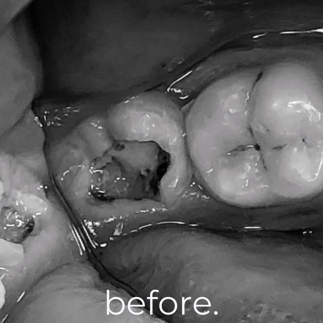 Treatments & Portfolio Fidelity Dental Bali