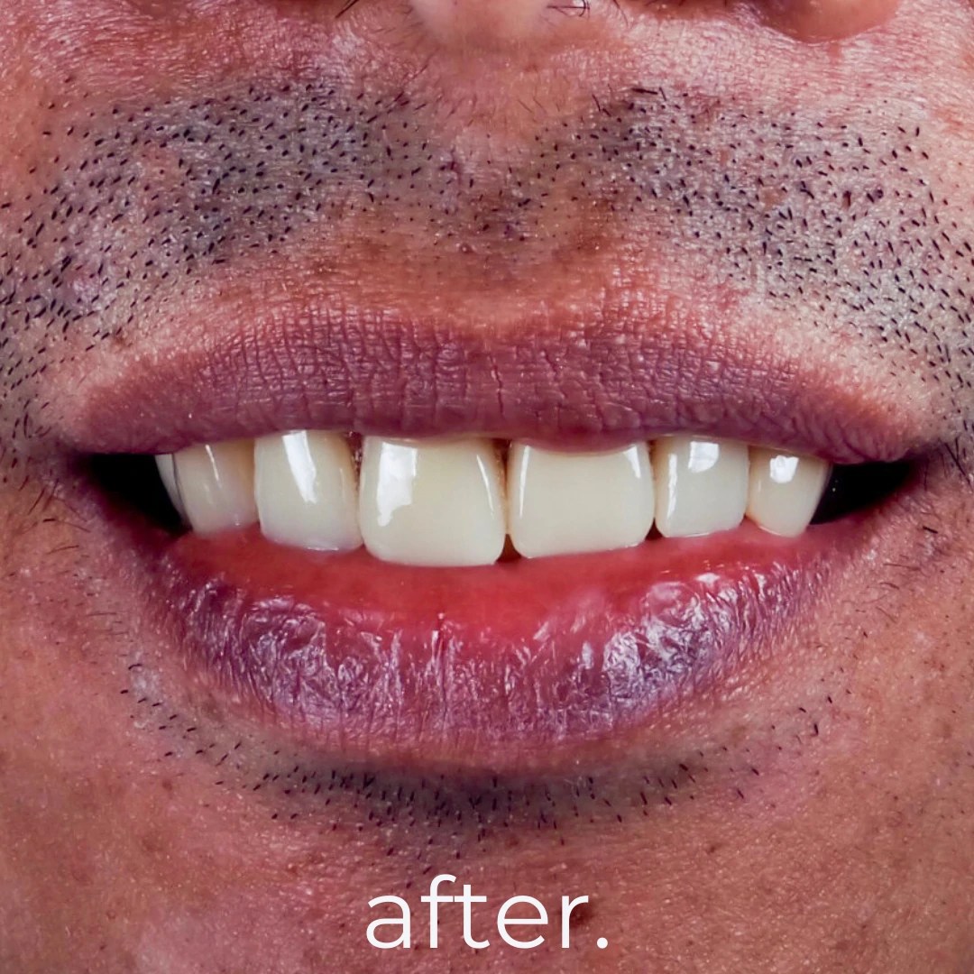 Treatments & Portfolio Fidelity Dental Bali