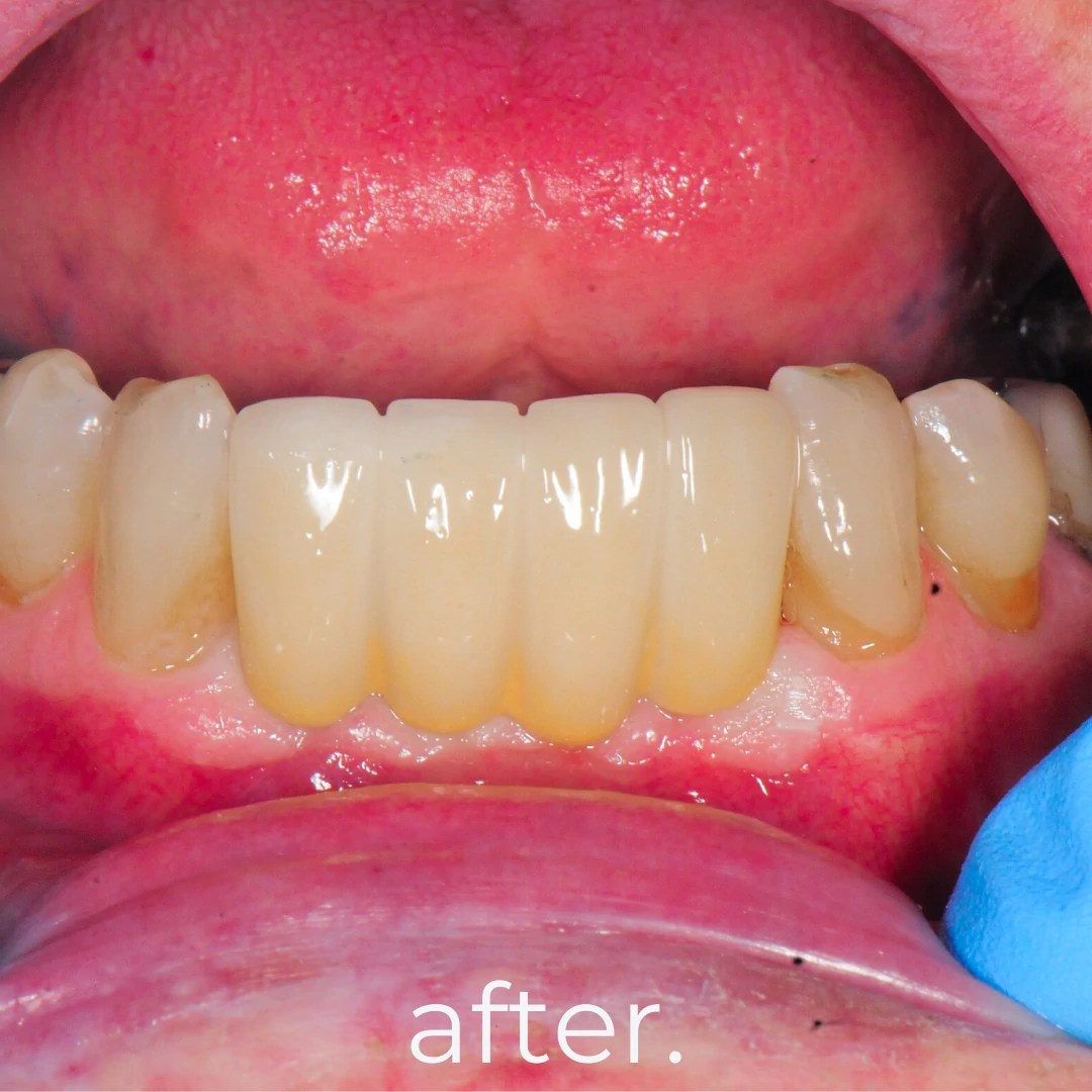 Professional & Trustworthy Bali Dentist Fidelity Dental Bali