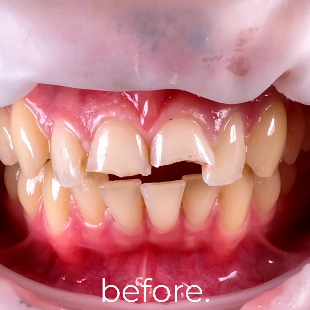 Treatments & Portfolio Fidelity Dental Bali