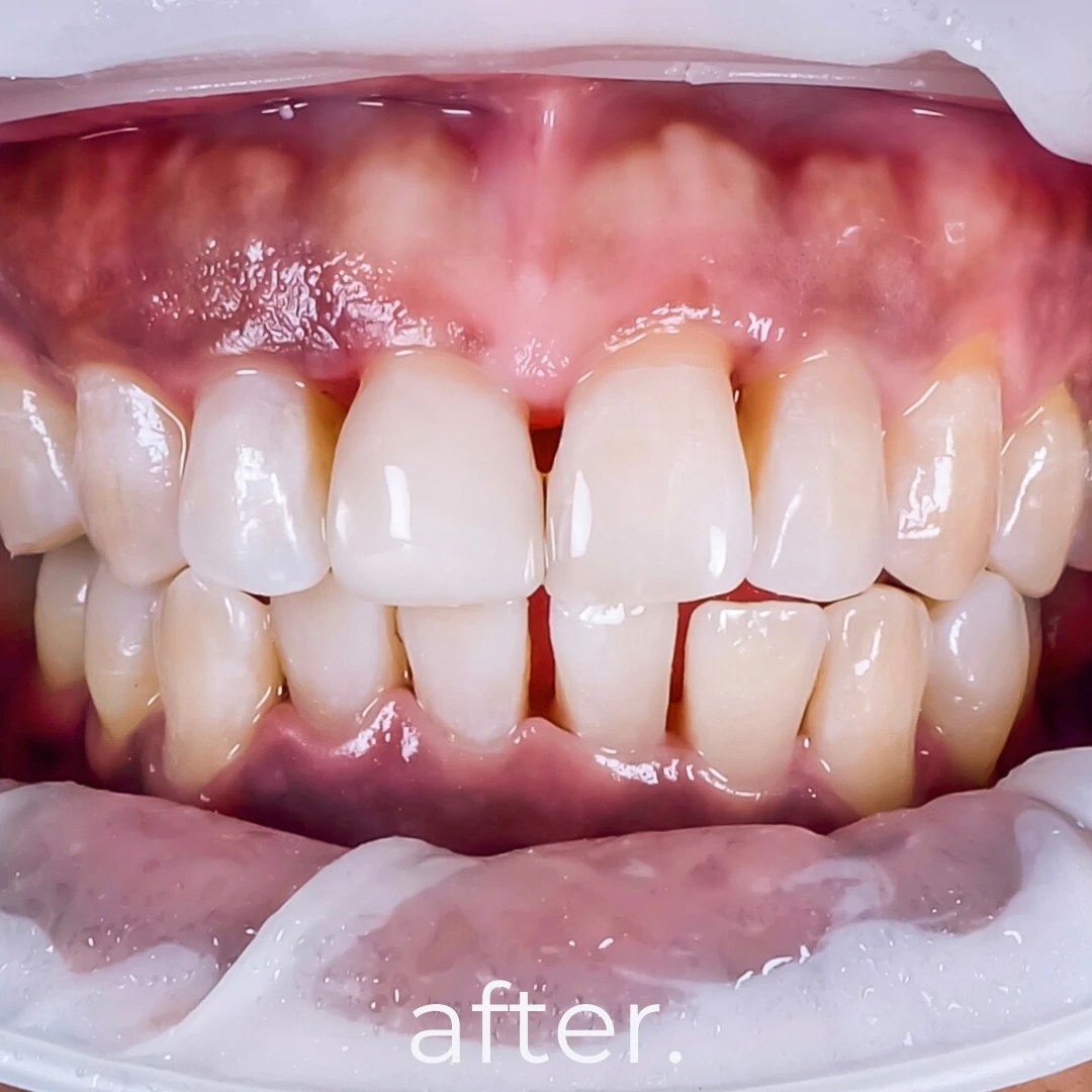 Treatments & Portfolio Fidelity Dental Bali