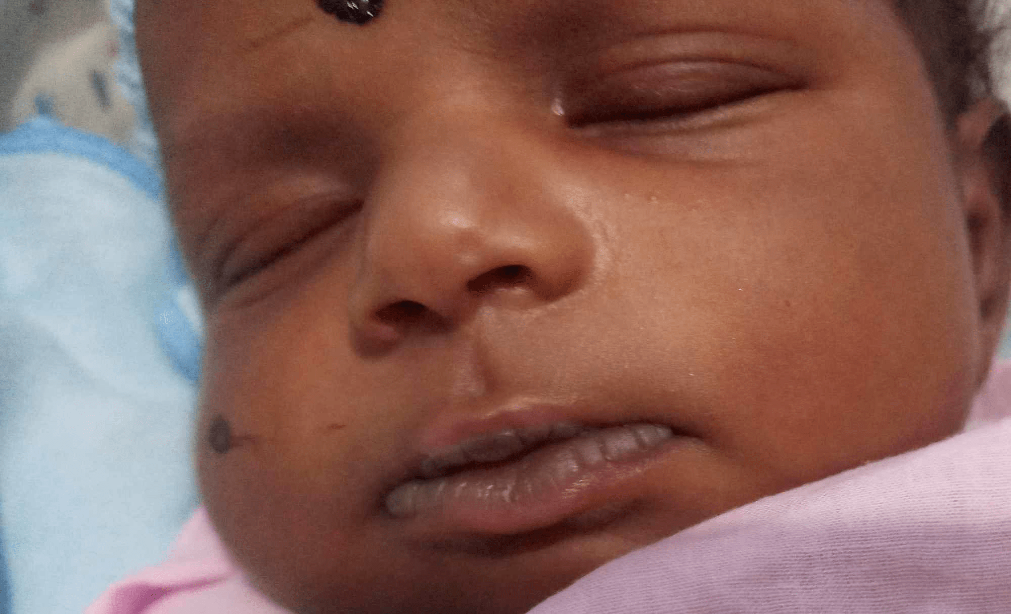 Newborn Care Mouth Philadelphia FIGHT