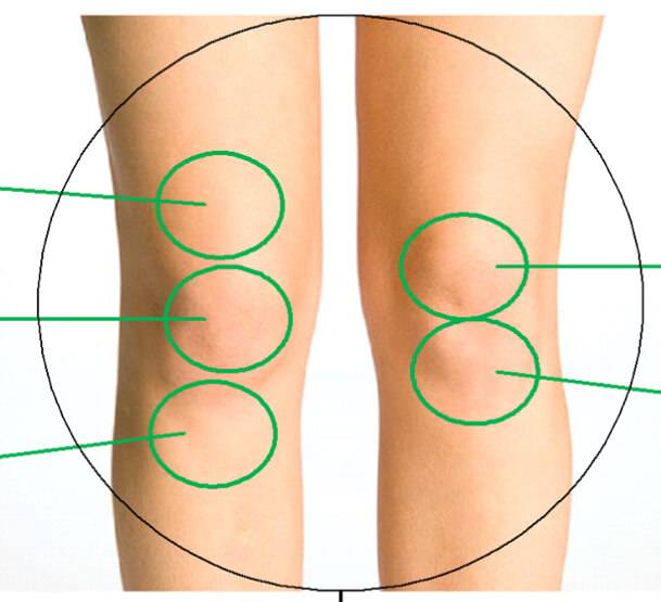 Decoding the Mystery Unveiling the Cause of Front Knee Pain