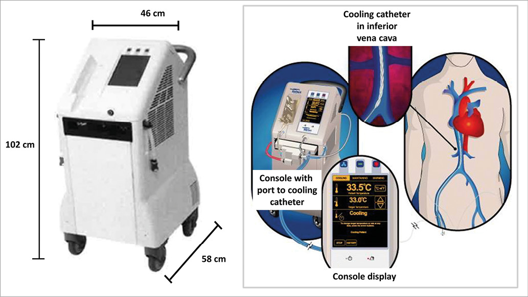 COOL AMI EU pilot trial a multicentre, prospective, randomised