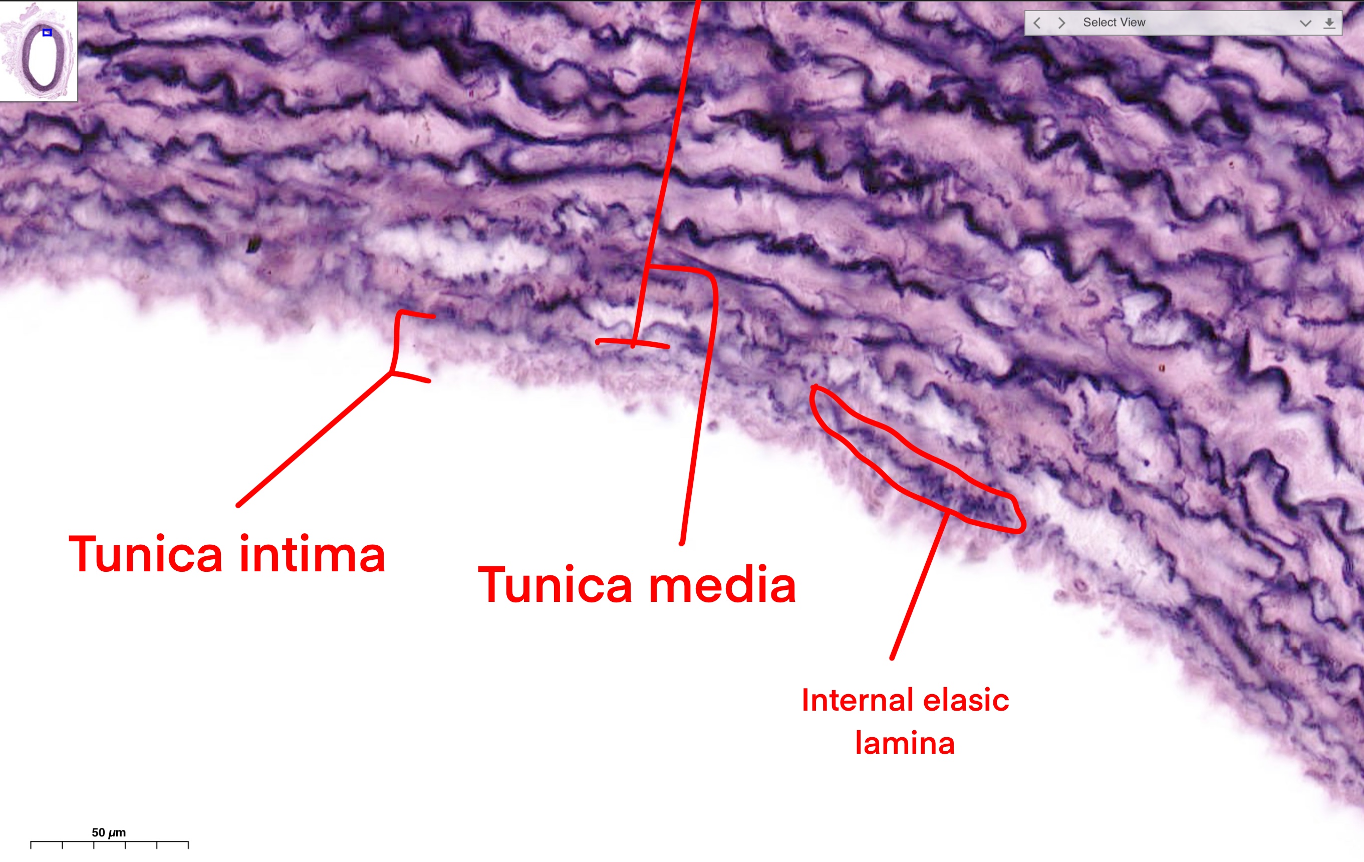 Muscular Artery Vs Elastic Artery Histology