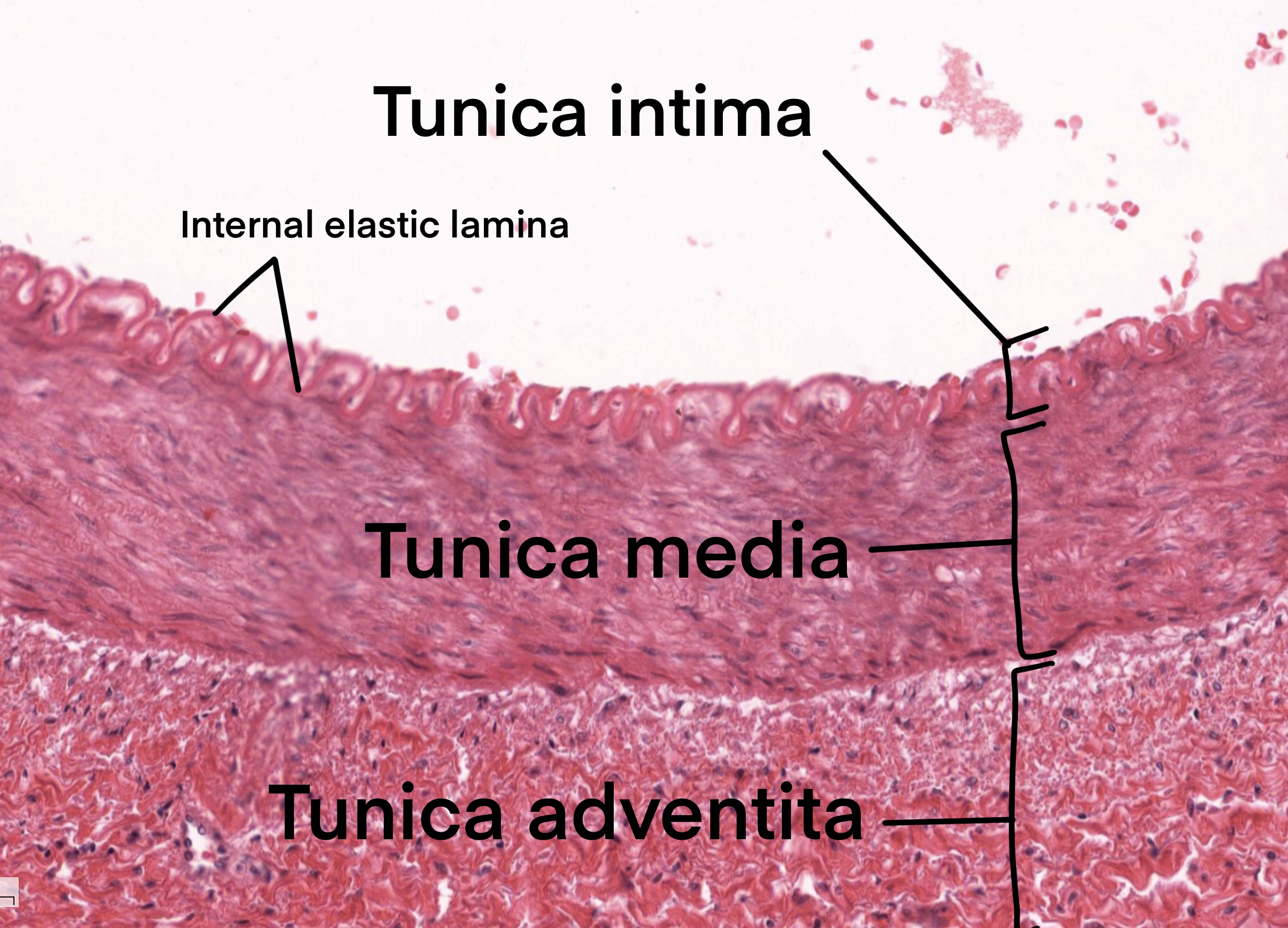 Artery Tunica Intima