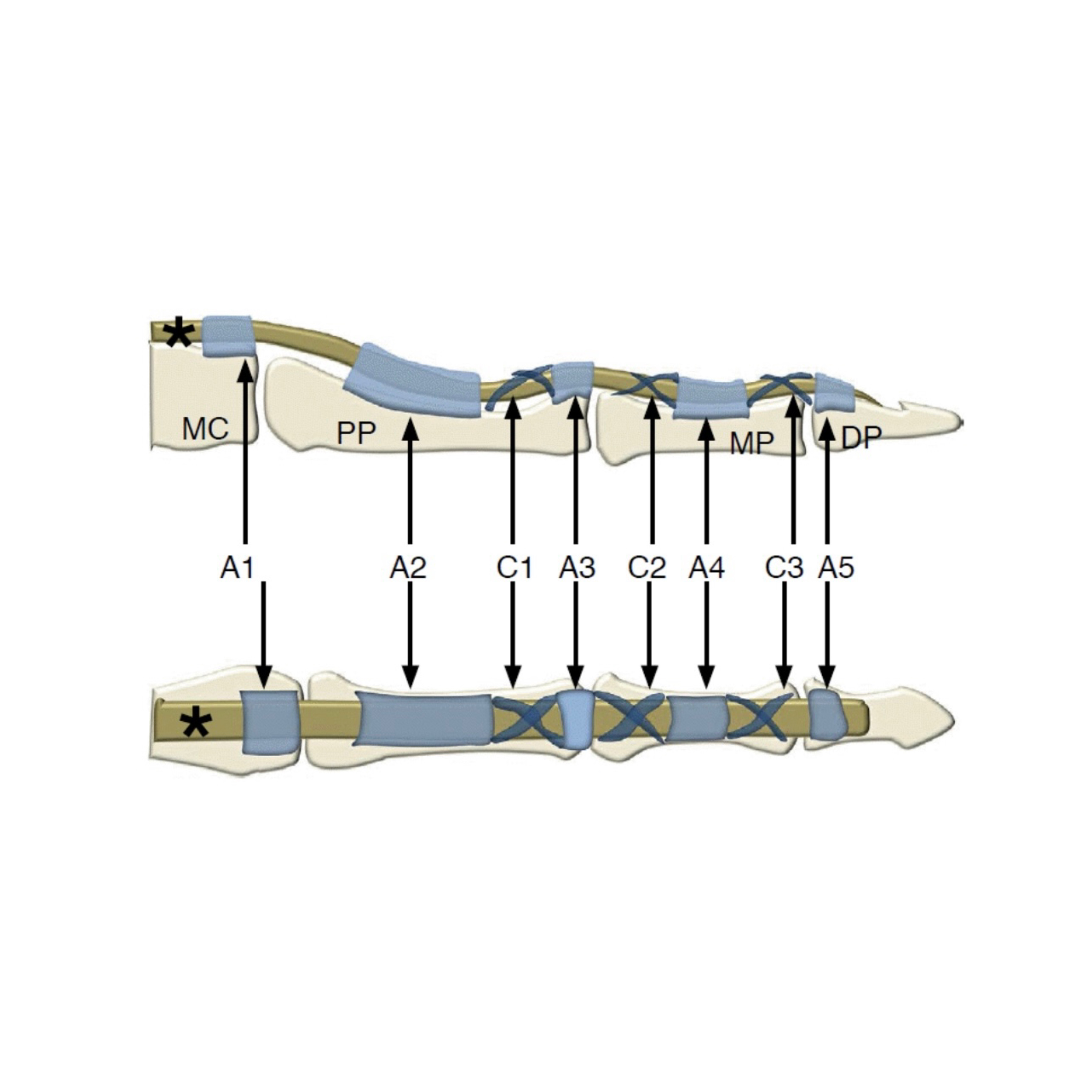 Flexor Pulley System of the Fingers