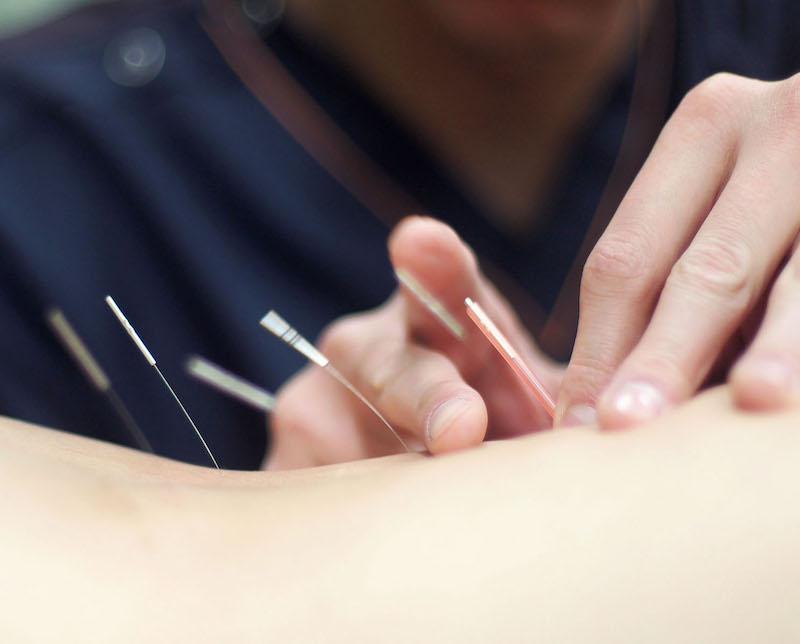 NCCIH Timeline NCCIH