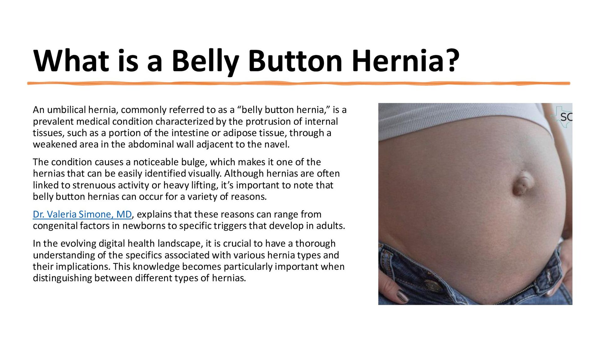 Belly Button Hernia A Quick Guide! Speaker Deck