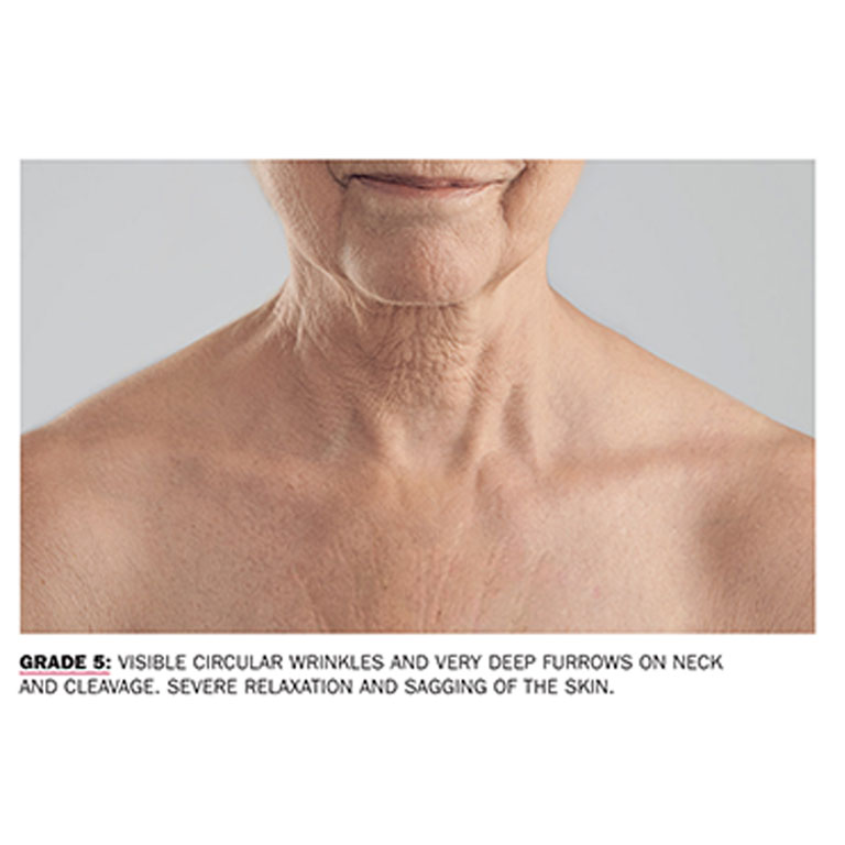 Neck and Cleavage Replenishing Gel Fillerina® USA