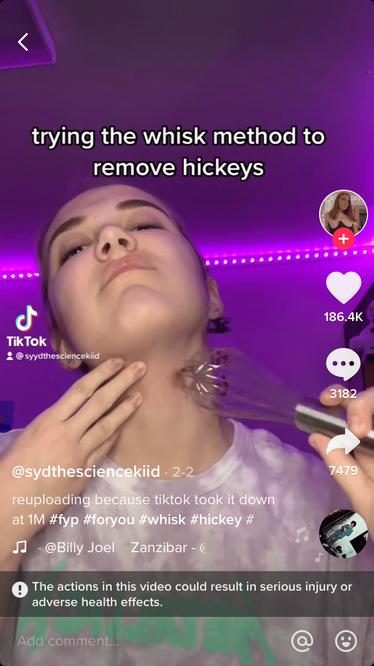 TikTok Teens are Using Whisks To Get Rid Of Hickeys In One Of The