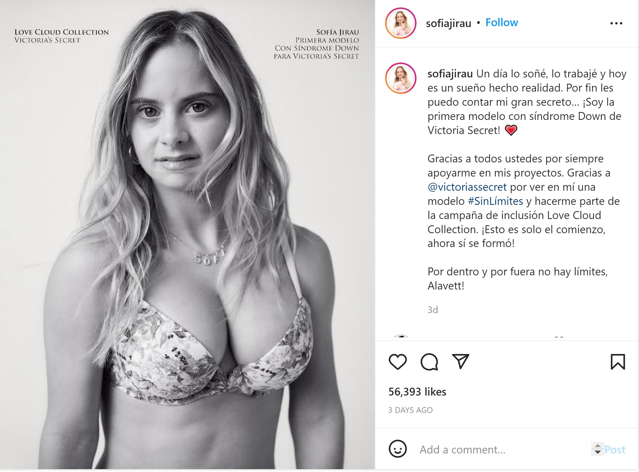 Victoria's Secret Introduces First Model With Down Syndrome And It's