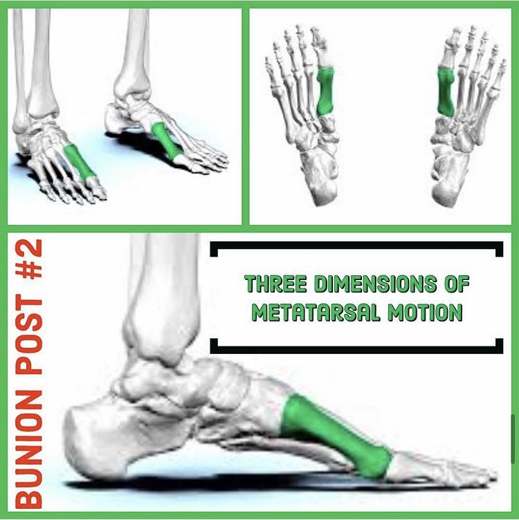 Bunions A 6Part Series Finding Centre