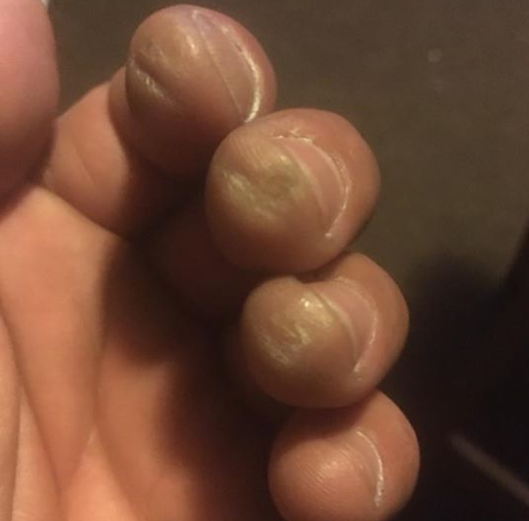 Ultimate Guide to Fingerpicking