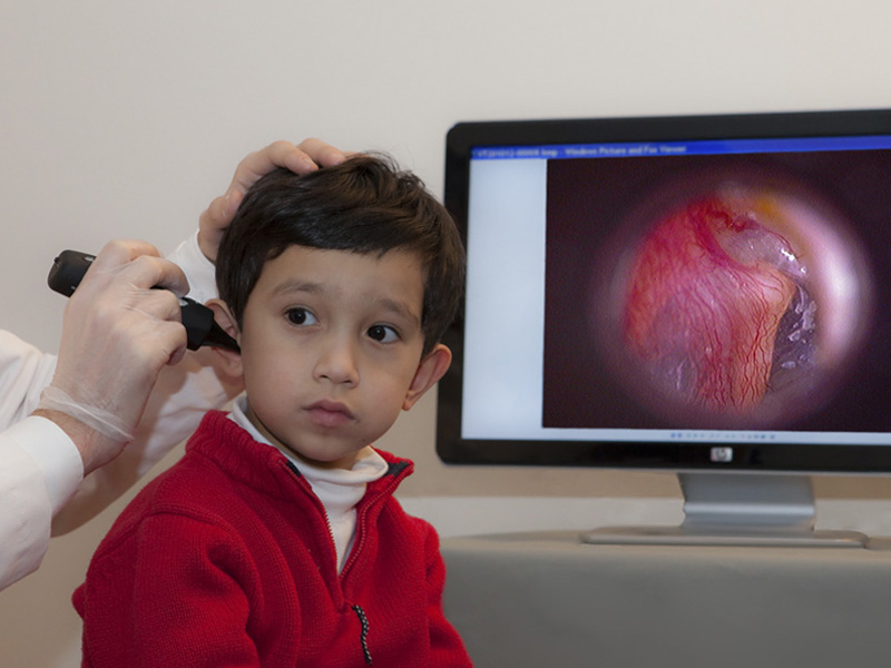 Wireless Video Otoscope Firefly Global