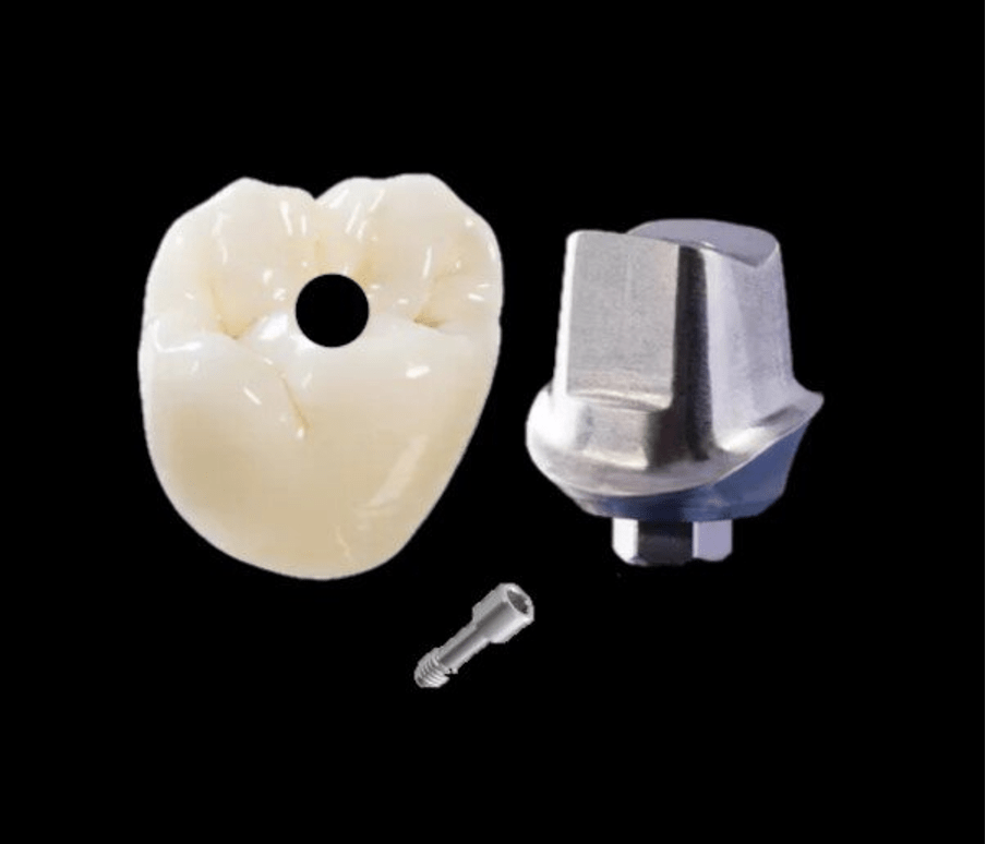 Implants First Choice Dental Lab