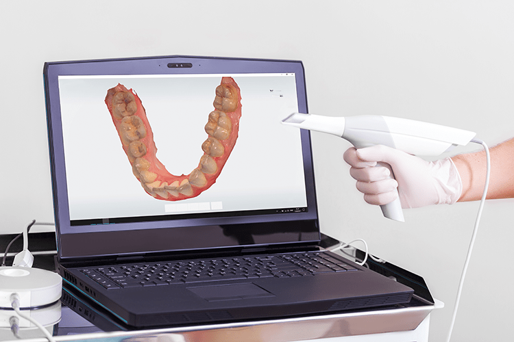 Why It's Time to Choose Digital Dentures First Choice Dental Lab