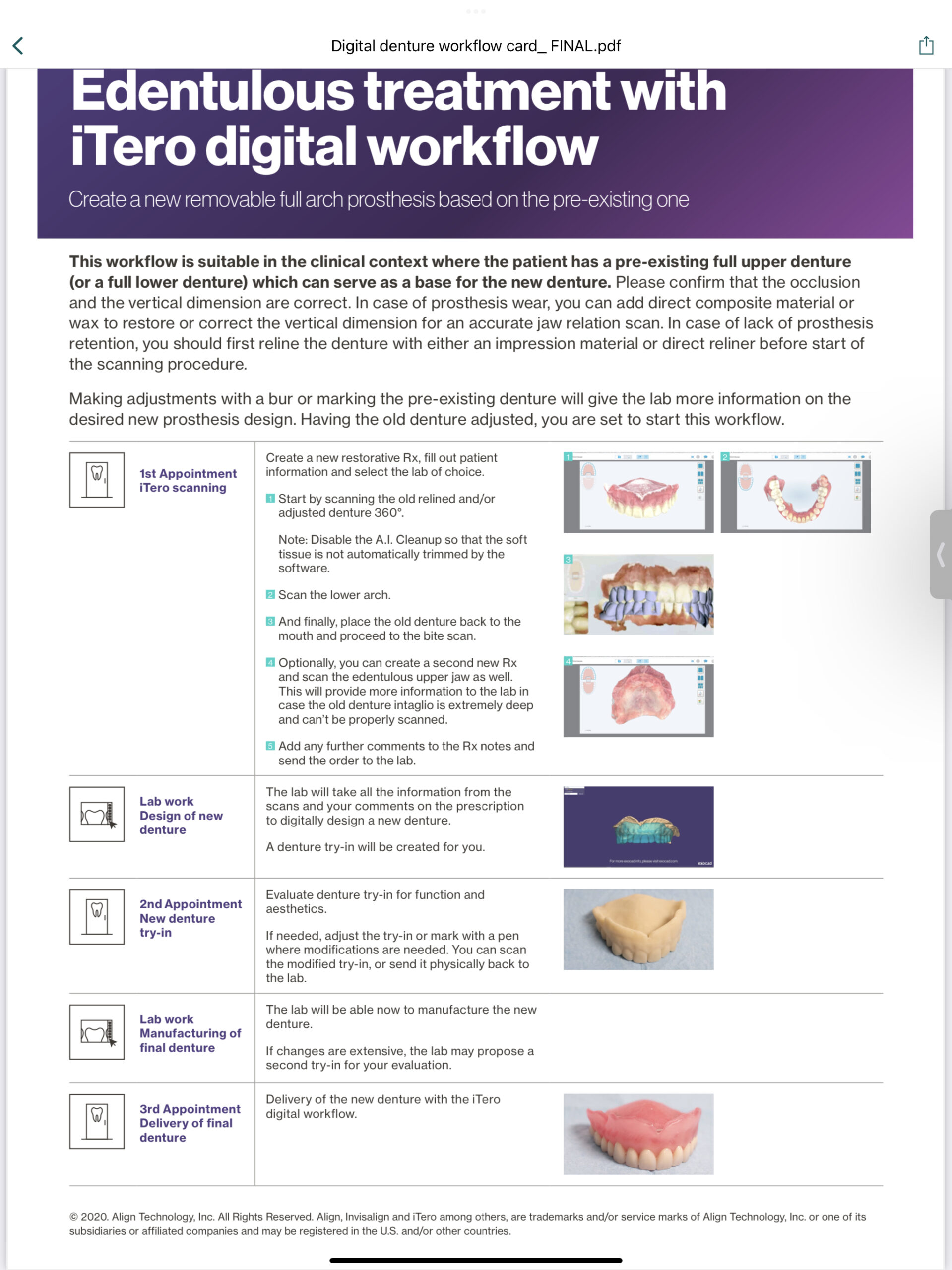 Digital Dentures First Choice Dental Lab